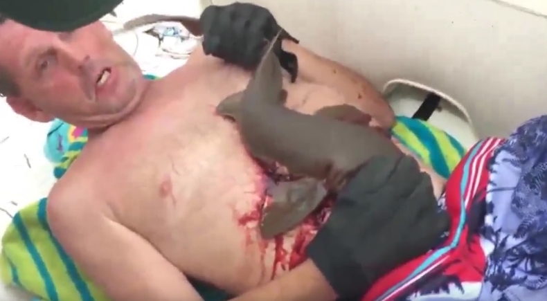 Rekin wgryzł się w brzuch mężczyzny. Szokujące wideo - GospodarkaMorska.pl